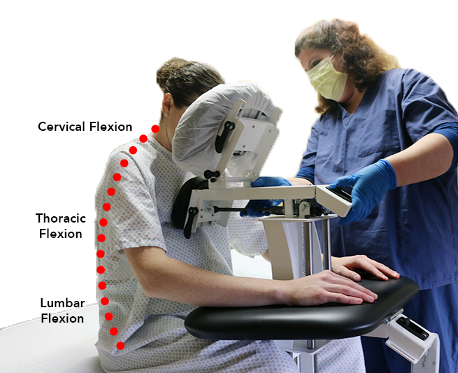 Overweight Patients and Epidurals