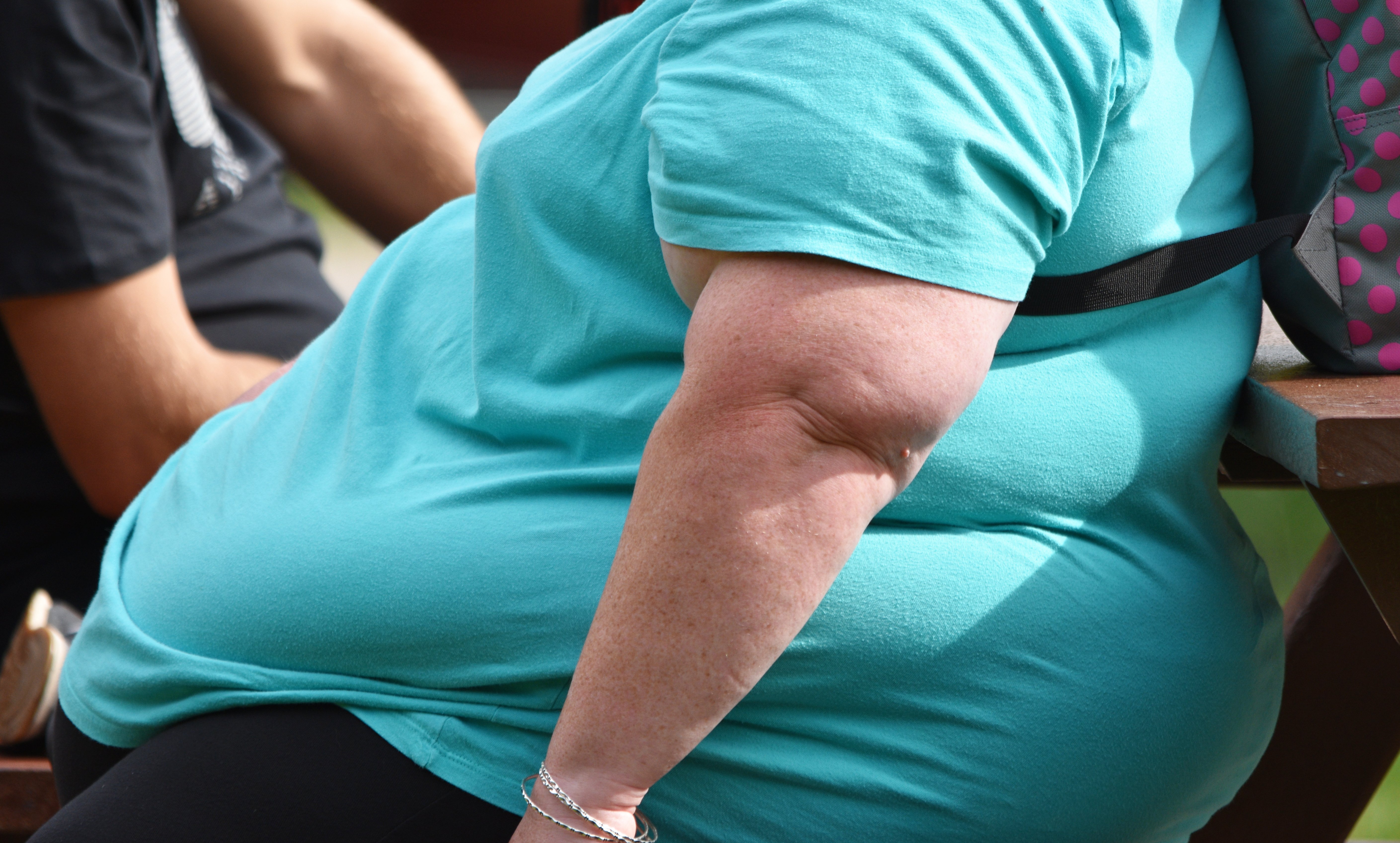 Practical Tips For Managing Super Morbidly Obese Patients